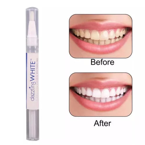 Professional Teeth Whitening & Stain Removing Pen For Men/Women
